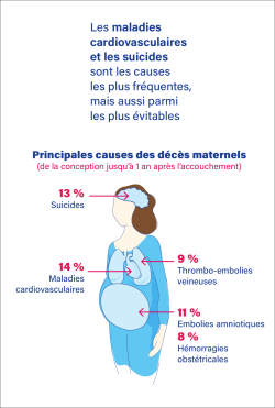 Vignette-Infographie_Mortalité Maternelle_06012021 copie